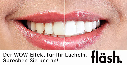 Vorher-Nachher-Vergleich einer Zahnaufhellung mit dem fläsh-System in Minden: Sichtbare Aufhellung der Zahnfarbe.