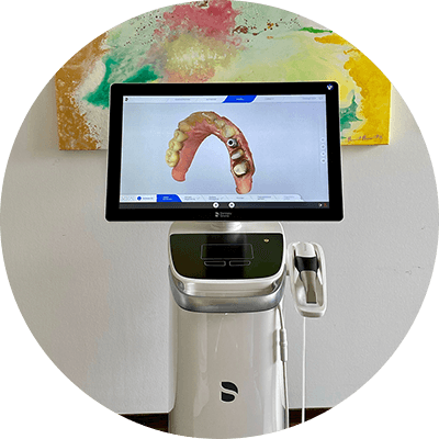 Digitaler Abdruck: Intraoralscan für präzisen Zahnersatz in Minden